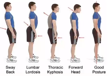 Spine posture infographic