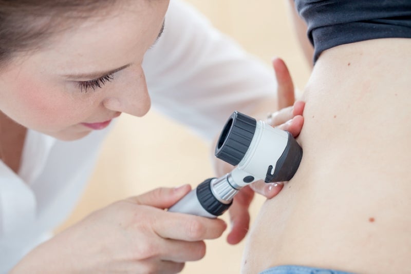 doctor checking skin for skin cancer