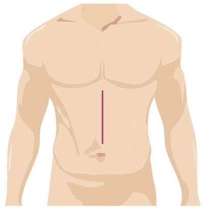 surgery