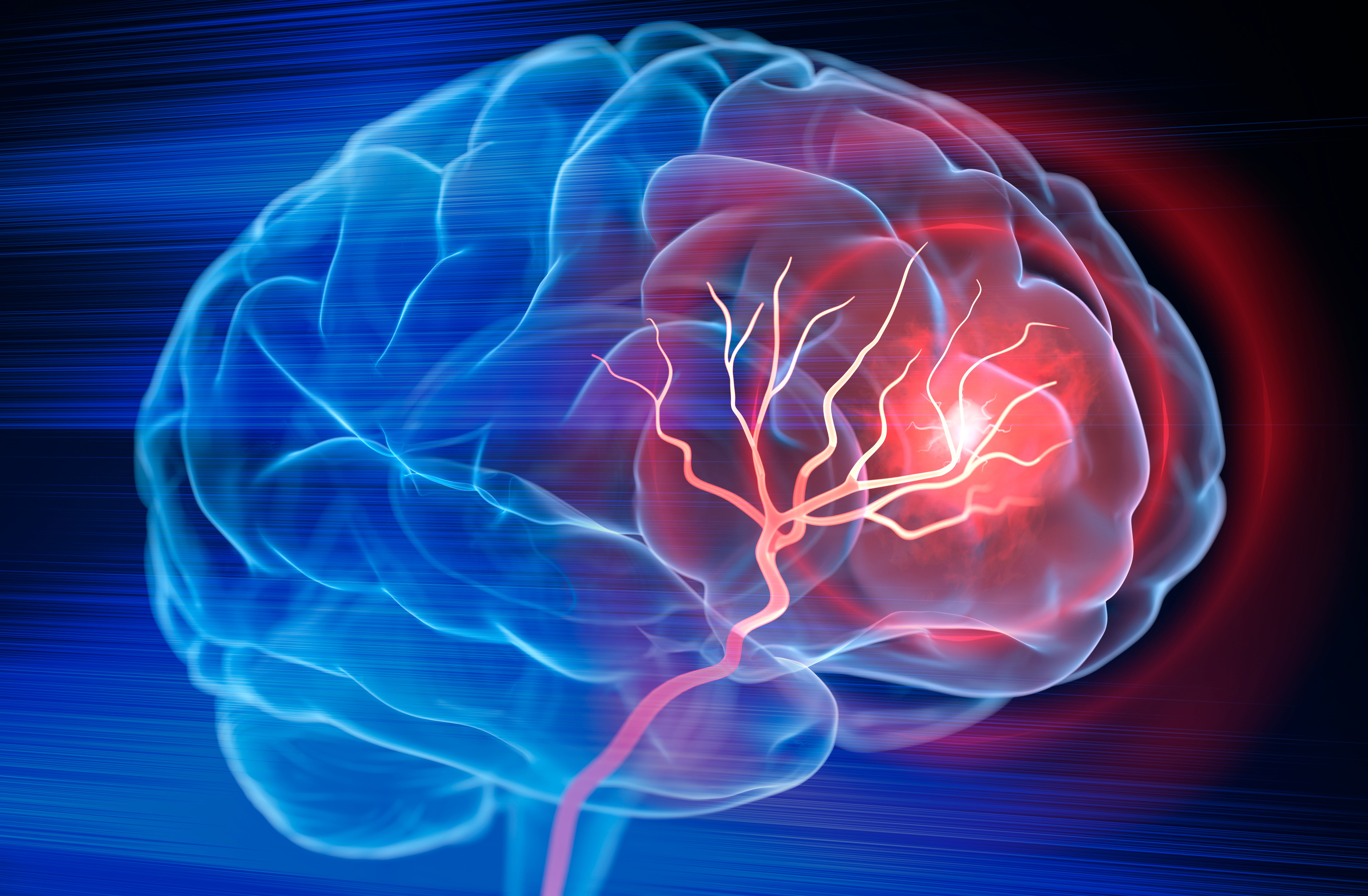 human brain with identified area of trauma