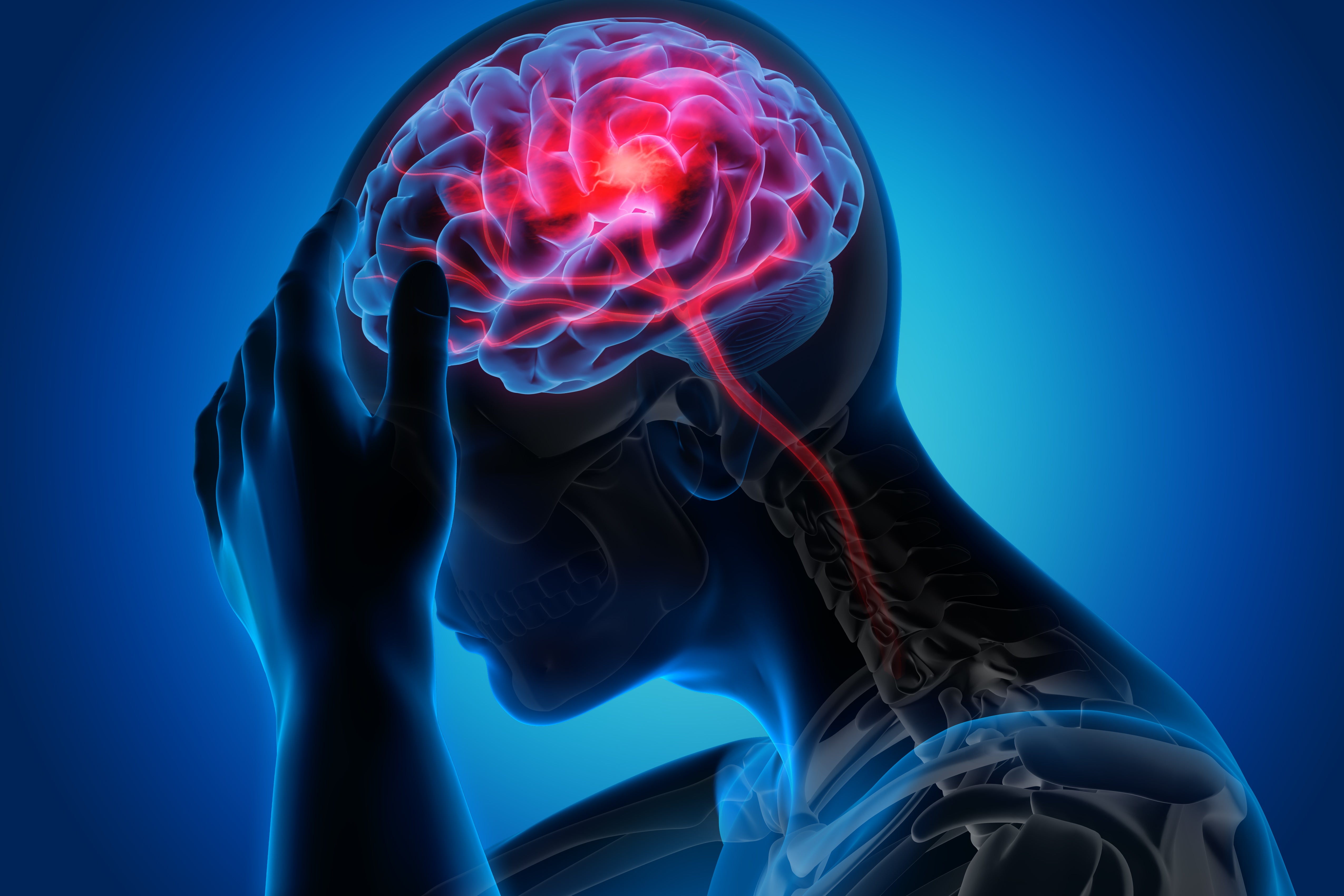 Person having a stroke holding his head