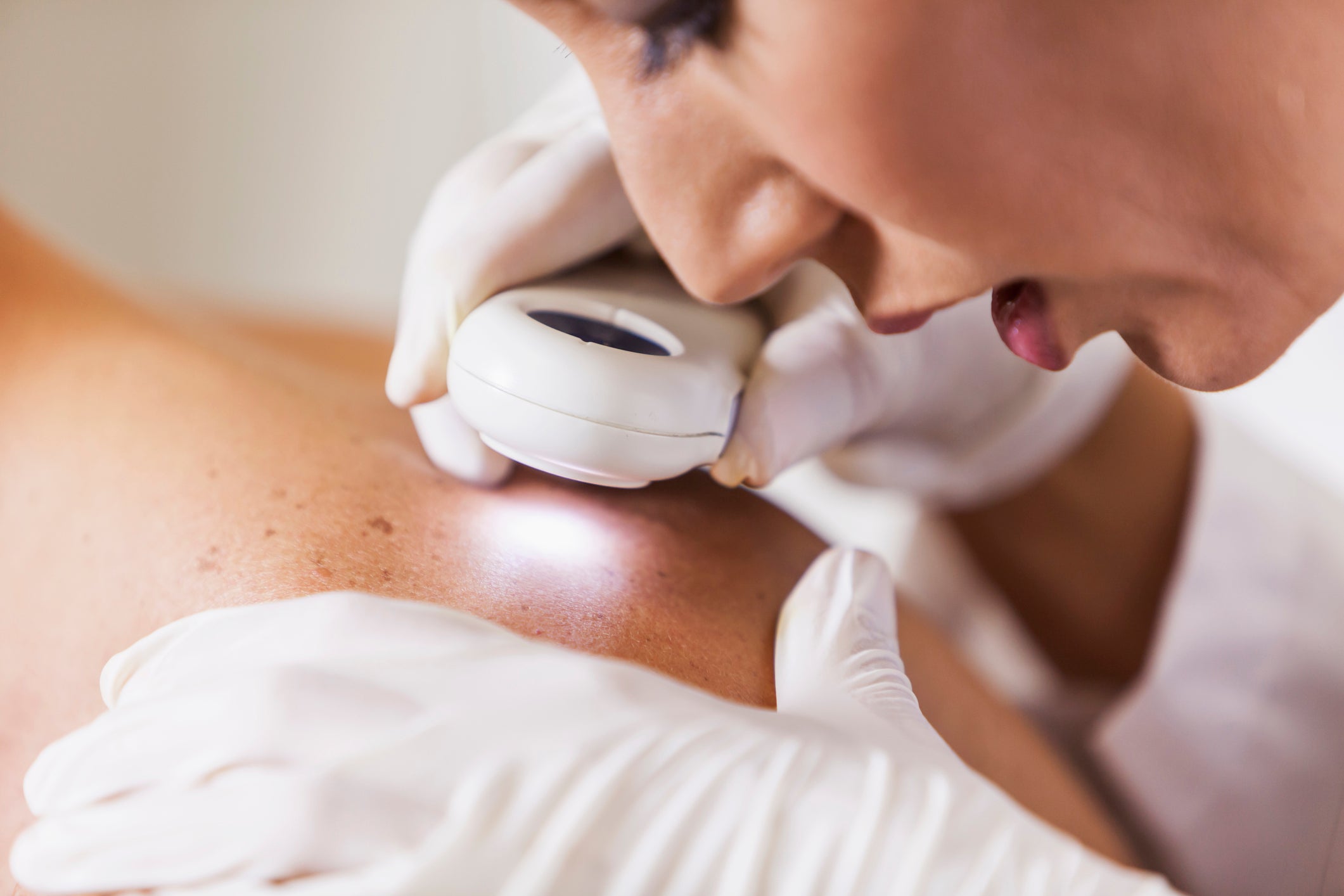 Physician Examining Patient Skin