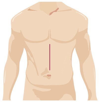 surgery