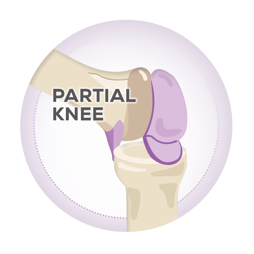 knee